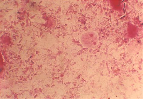 these species cause cryptosporidiosis in vertebrates, especially neonates. Oocyst of Cryptosporidium spp. | Download Scientific Diagram