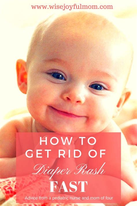 How To Heal Diaper Rash Quick New Ternds