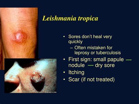 Ppt Leishmaniasis Powerpoint Presentation Free Download Id