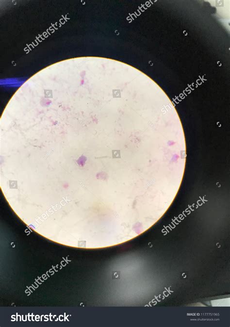 Trichomonas Vaginalis Light Microscope Stock Photo 1177751965