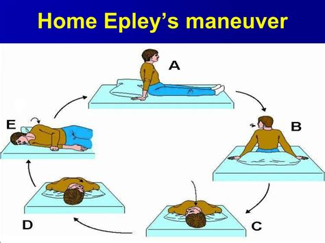 Eplie Epley Maneuver Instructions Spanish To Access This Post You
