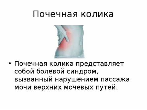 Почечная колика диета номер Презентация "Почечная колика" Презентация "Почечная колика" Почечная колика диета номер