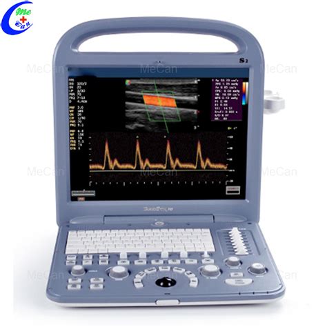 Sonoscape S2 Portable Color Doppler Echo Machine Echocardiography
