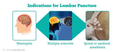 Lumbar Puncture Spinal Tap Preparation Indications Procedure