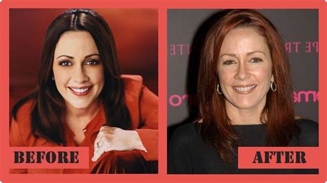 Patricia Heaton Plastic Surgery Before And After Patricia Heaton