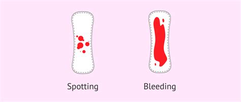 Spotting During Pregnancy Early Pregnancy