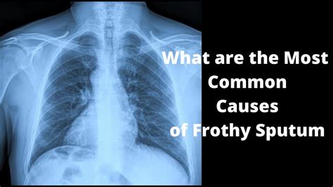 What Are The Most Common Causes Of Frothy Sputum Youtube