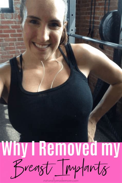 Why I Removed My Breast Implants No Regrets Naturally Made Mom