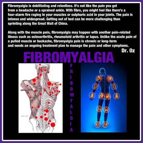 Fibromyalgia Chronic Fatigue Syndrome Diet Chronic Fatigue Symptoms