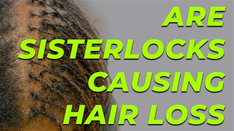 Also, it increases oxidative stress and associated hair damage (v). Do Sisterlocks Cause Hair Loss - YouTube