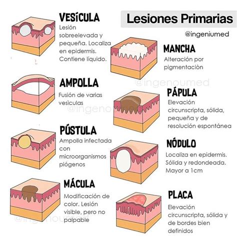 La clasificación se basa en los atributos de la lesión. Lesiones Primarias de Piel - Ingeniumed