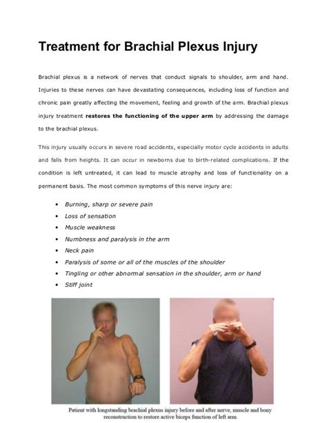Brachial Plexus Palsy Causes Symptoms Treatment Diagn