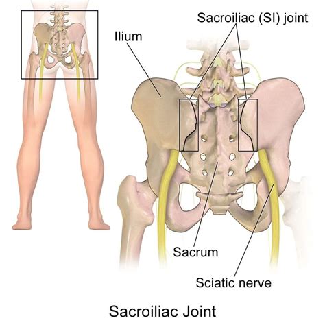 Sacroiliac Joint Dysfunction X Ray