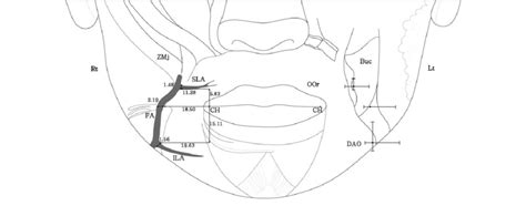 Schematic Drawing Shows The Major Course Of The Facial Artery And Its