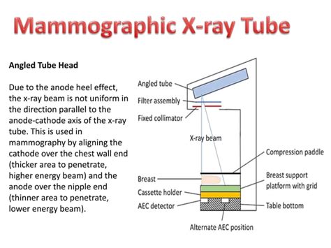 x ray tube cassette and screens