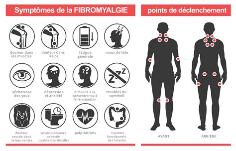Fibromyalgie Causes Symptômes Et Traitements Information