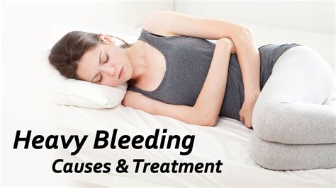 Heavy Bleeding Causes And Treatment Youtube