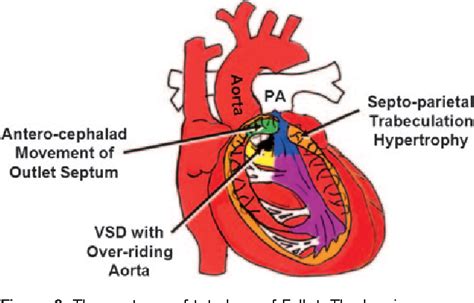 Figure 3 From Adult Congenital Heart Disease Right Ventricular Outflow