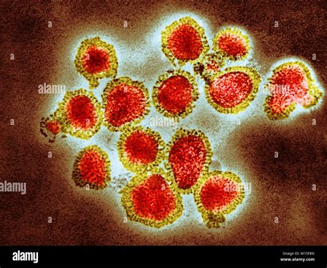 H3n2 Influenza Virus Particles Coloured Transmission Electron