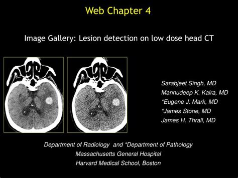 Ppt Image Gallery Lesion Detection On Low Dose Head Ct Powerpoint Presentation Id