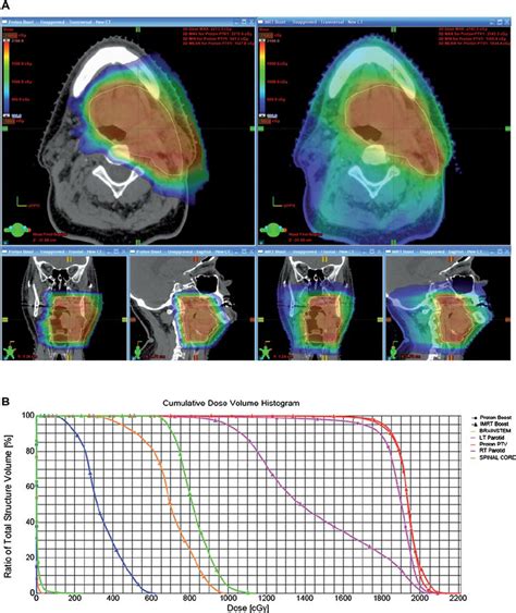 this shows a comparison of an intensity modulated radiotherapy imrt download scientific