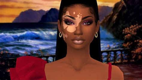The Sims 4 Cas Vitiligo Beauty Full Cc Links Youtube