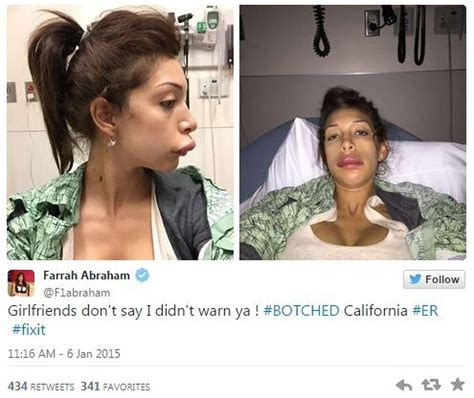 Porn Star Farrah Abraham S Plastic Surgery Goes Terribly Wrong She Owns It