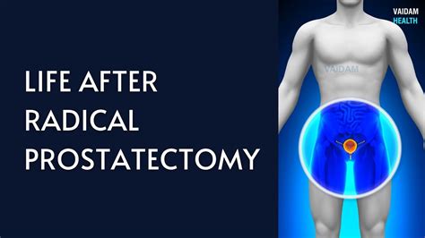 Life After Radical Prostatectomy Youtube
