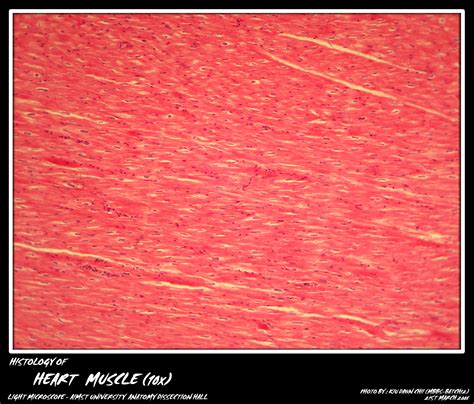 Cardiac Muscle Tissue Microscope
