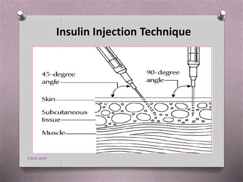 Ppt Insulin Administration Powerpoint Presentation Free Download Id7024376