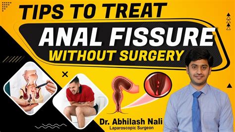 Anal Fissure Treatment Without Surgery Laser Surgery For Fissure Dr Abhilash Nali Youtube