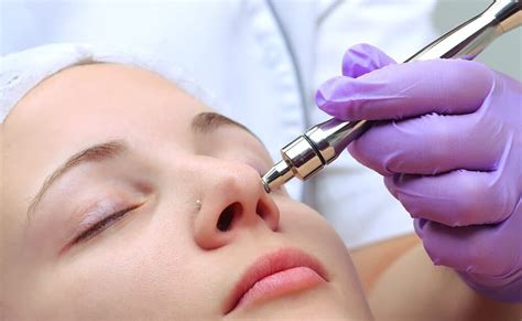 Microdermabrasion In Oakville Unveiling Your Skins Timeless Glow Comptonherald
