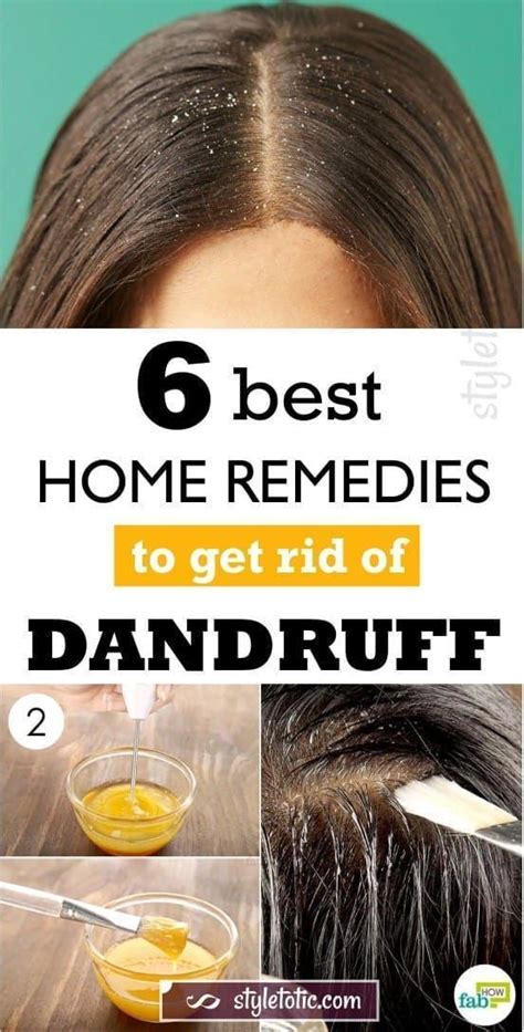 Hence, instead of investing your time and money in such treatments, if you have mild hair fall, it is better to opt for natural alternatives that are completely safe for your scalp and skin. How to Get Rid of Dry Scalp? Best Home Remedies | Home ...