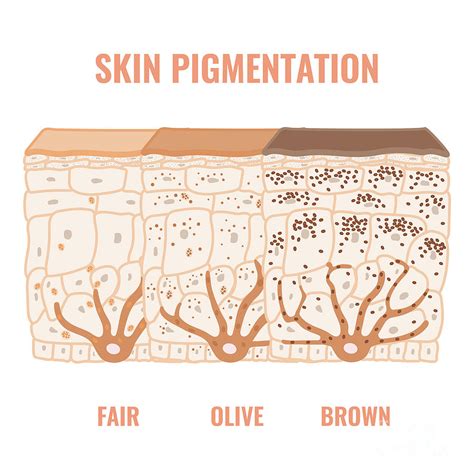 Skin Pigmentation Photograph By Art4stockscience Photo Library Fine