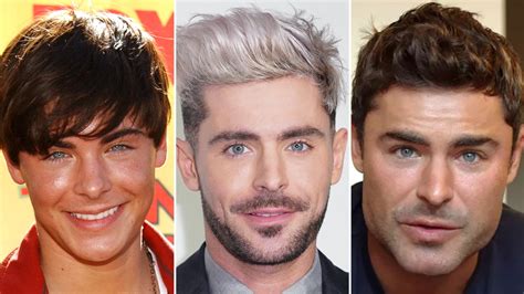 did zac efron get plastic surgery everything we know