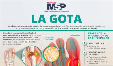 EMS SOLUTIONS INTERNATIONAL By DrRamonReyesMD Marca Registrada LA GOTA Artritis Gotosa