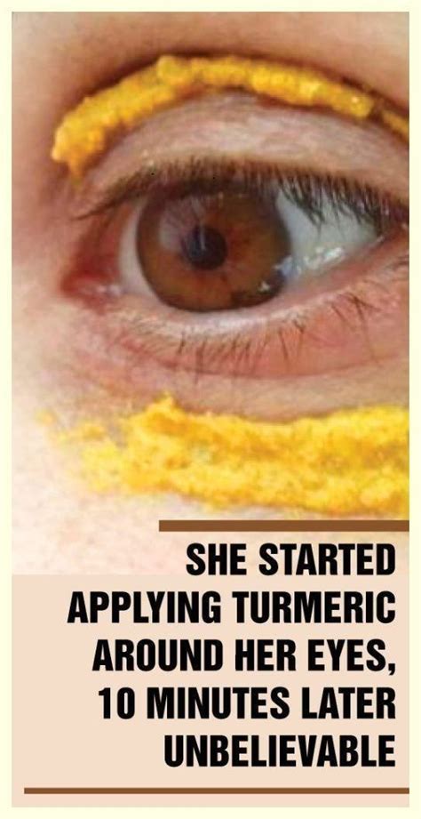 SHE STARTED APPLYING TURMERIC AROUND HER EYES 10 MINUTES LATER