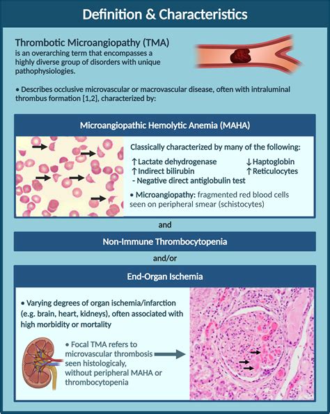 thrombotic microangiopathies an illustrated review research and practice in thrombosis and