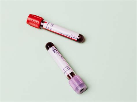 New Multi Cancer Early Detection Blood Test Study Opens Nihr Oxford