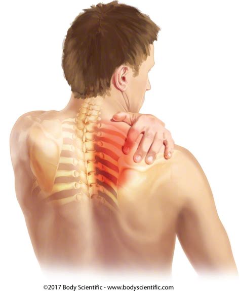 Thoracic Spine Pain Seriousmumu