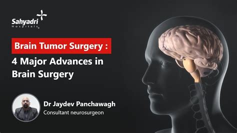 4 Major Advancements In Brain Surgery Sahyadri Hospital