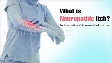 Neuropathic Itch Causes Symptoms Treatment Prognosis