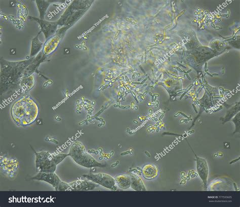 Стоковая фотография 777593605 Bacteria Yeast Fungus Contamination Cell