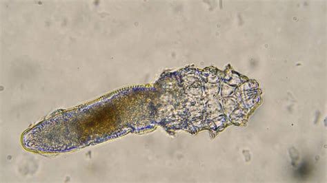 Demodex Mites Under The Microscope Ungex Demodex Treatment