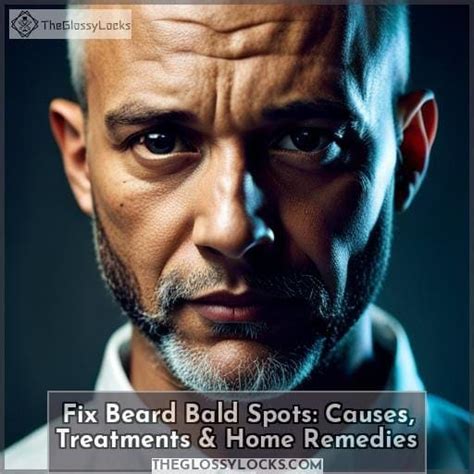 Fix Beard Bald Spots Causes Treatments And Home Remedies