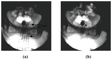 A Dwell Position Verification Method For High Dose Rate Brachytherapy