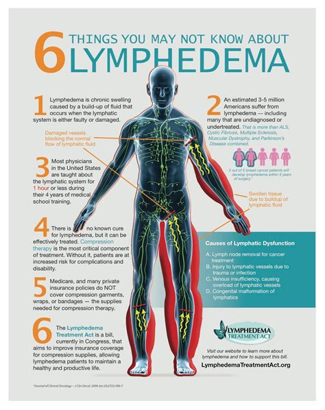 6 Things To Know About Lymphedema Lymphedema Treatment Lymphedema Lymphedema Awareness