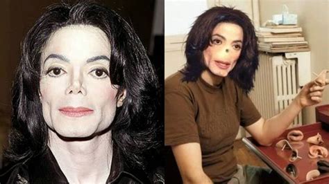 Michael Jackson Plastic Surgery Before And After