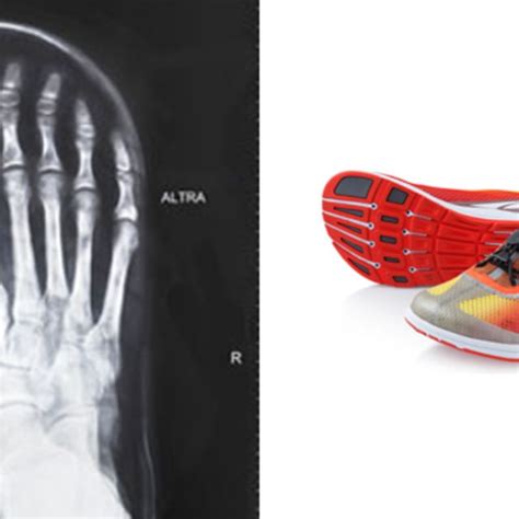 Know Your Tech Treat Your Toes With The Altra Foot Shaped Toe Box