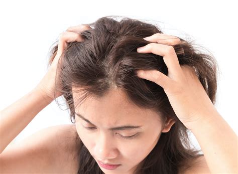 Get Rid Of Itchy Bumps On Scalp Itchy Bumps Scalps Itchy Vrogue